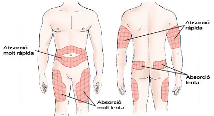 Imatge on s'especifica la velocitat d'absorci&oacute; de la insulina en funci&oacute; de la zona d'administraci&oacute;