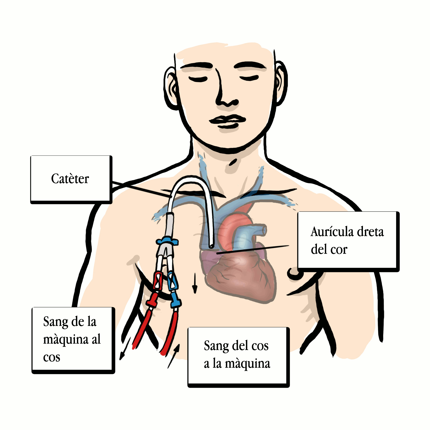 Cat&egrave;ter tunelitzat