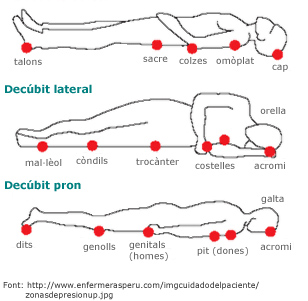 Zones de pressió Zones de risc per pressió