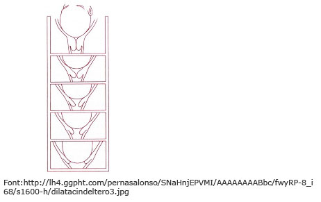 Canal part Esborrament i dilatació del coll uterí