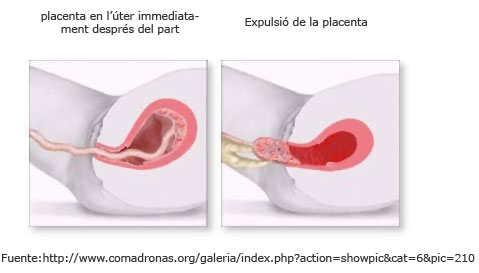 Expulsi&oacute;n de la placenta