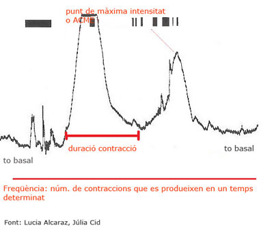 Gràfica d'una contracció Gràfica d'una contracció