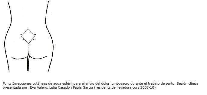 Zona de punci&oacute;