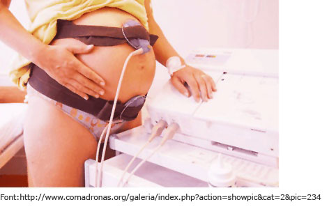 Registre cardiotocogràfic Registre cardiotocogràfic extern