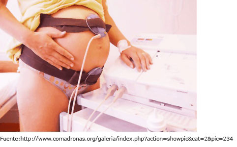 Registro cardiotocogr&aacute;fico externo