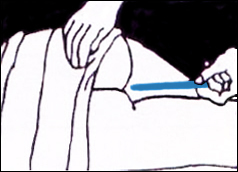 Toma de temperatura con el term&oacute;metro en el recto