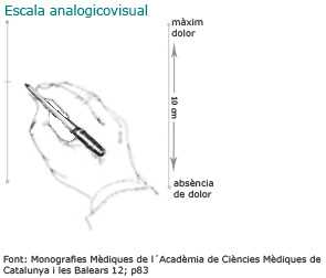 Escala analogicovisual: m&agrave; amb un bol&iacute;graf per fer un gr&agrave;fic del dolor sobre un paper