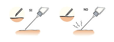 Com clavar injecció Manera correcta de introducir la aguja